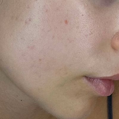 Та сама щока після лікування